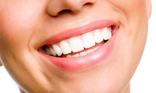 Cosmetic Dental Services